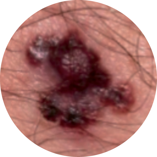 D=DIAMETER:If the diameter is greater than 6mm (the size of a pencils eraser)